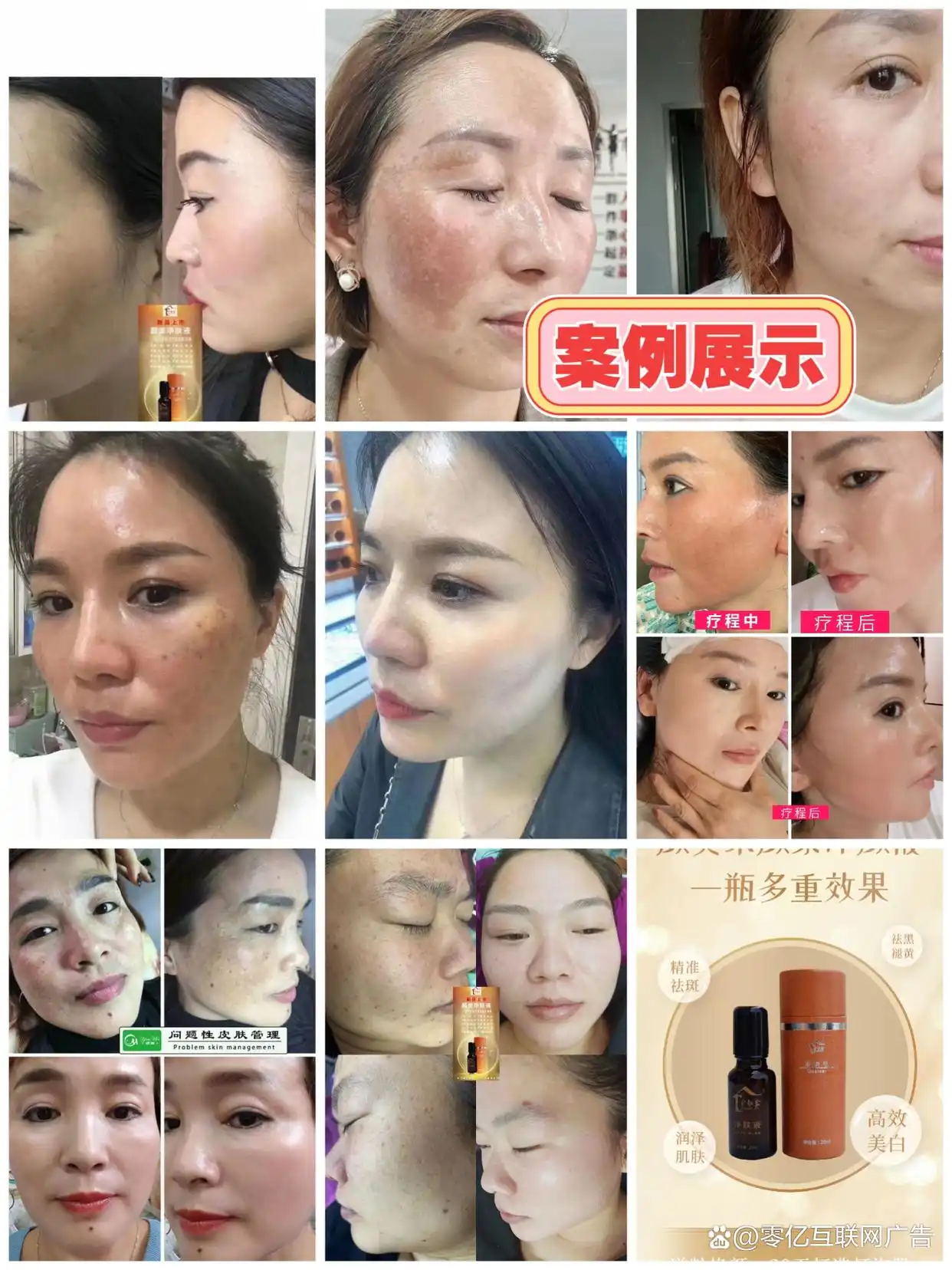 游泳冠军赵菁简介_世界游泳冠军赵锐代言_游泳冠军赵莹